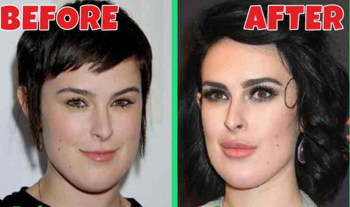 Rumer Willis before and after plastic surgery.