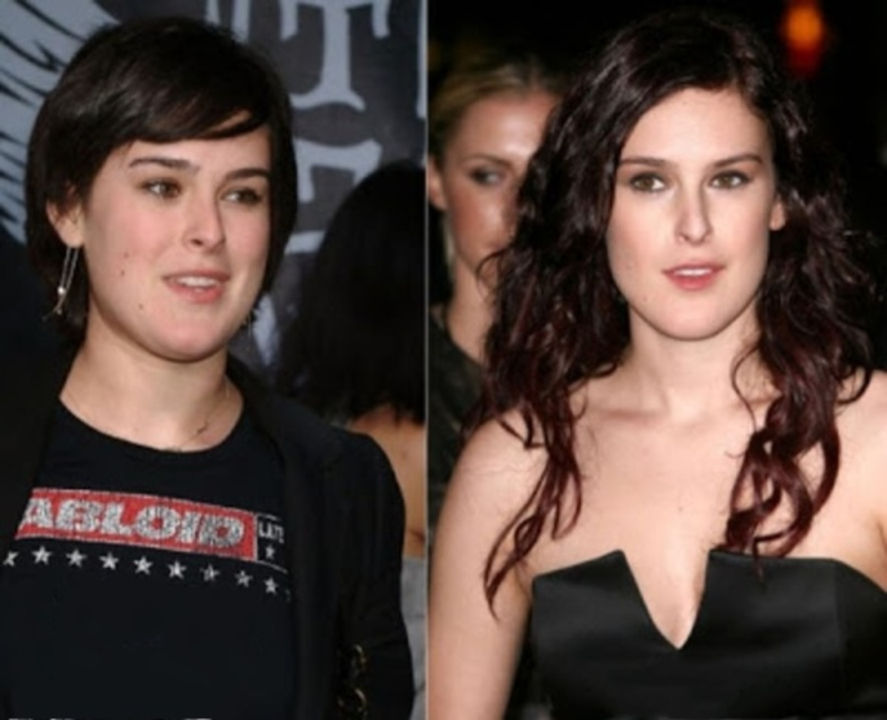 Rumer Willis before and after breast implants plastic surgery.