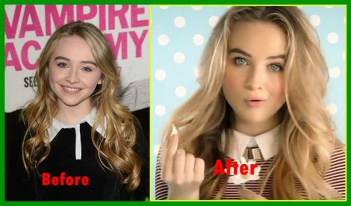 Sabrina Carpenter before and after nose job plastic surgery.