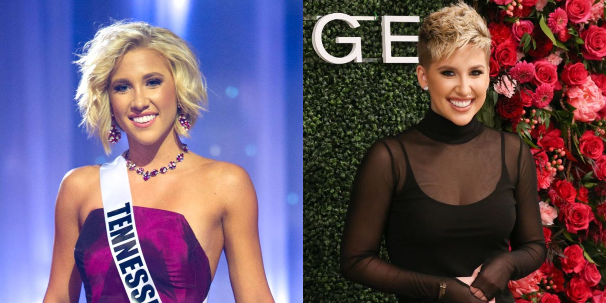 Savannah Chrisley before and after plastic surgery, notably nose job and breast implants.