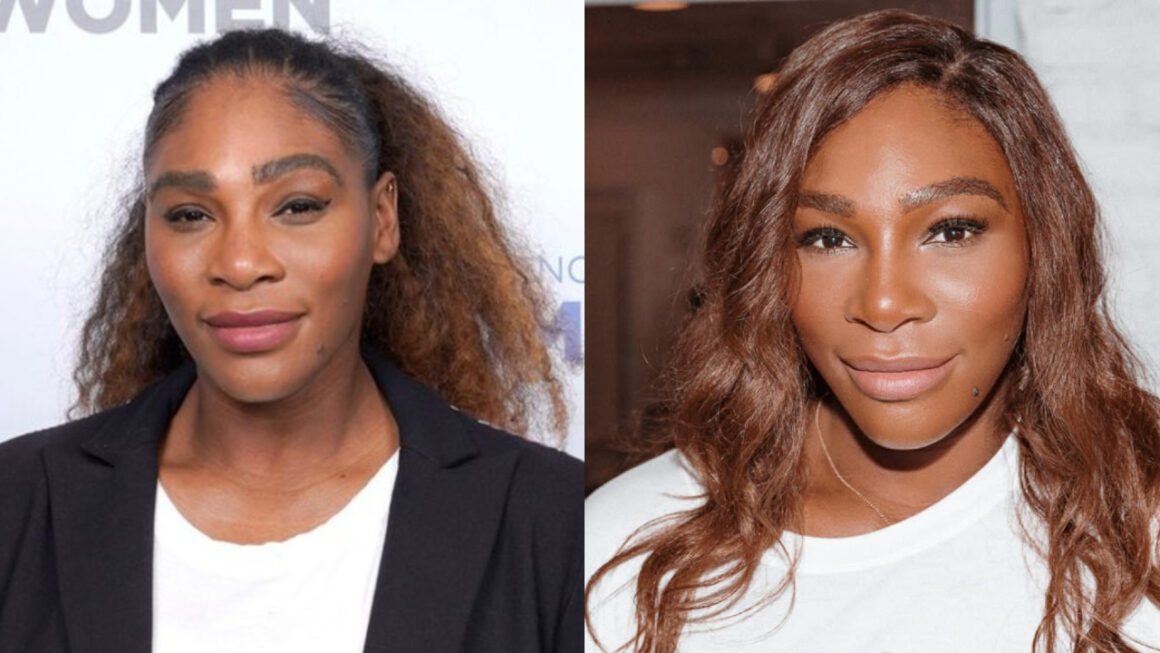 Serena Williams' Plastic Surgery - The Complete Breakdown!
