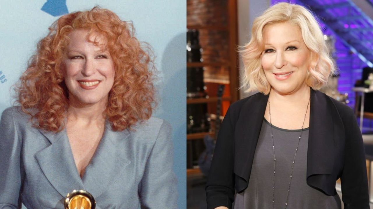 Bette Midler's plastic surgery includes a facelift, Botox injections & facial fillers.