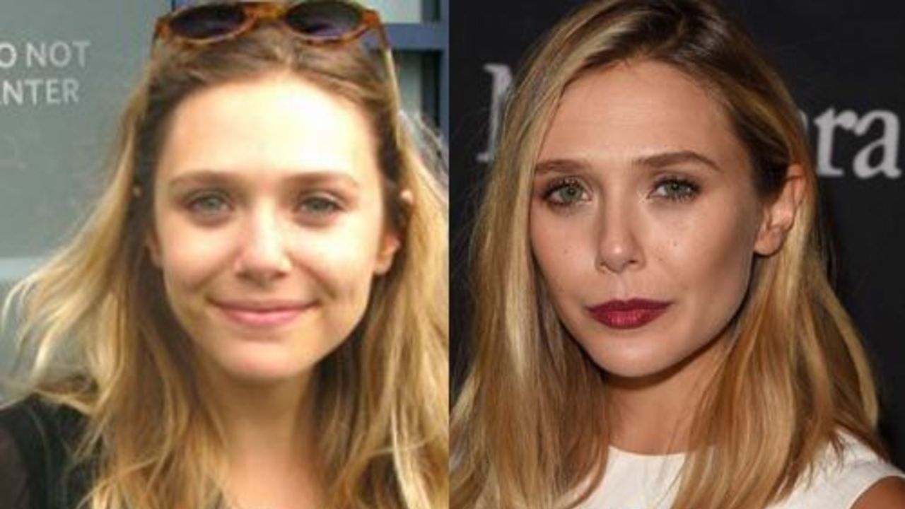 Elizabeth Olsen before and after alleged nose job plastic surgery. 