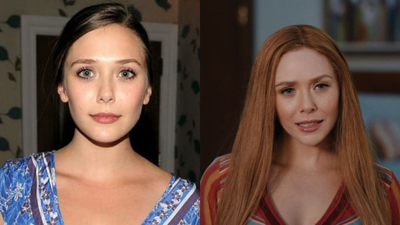 Elizabeth Olsen before and after plastic surgery, notably nose job aka rhinoplasty.