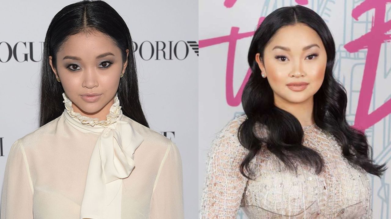 Lana Condor before and after lip fillers plastic surgery.