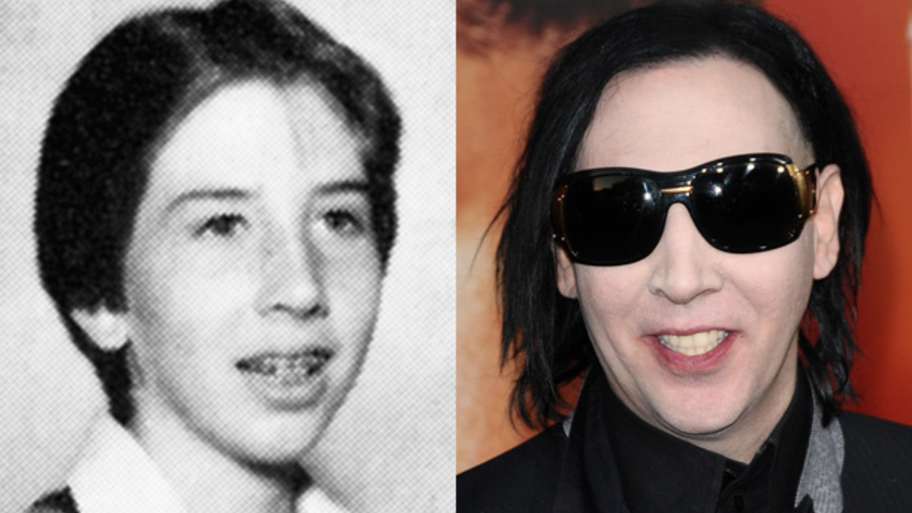 Marilyn Manson before and after plastic surgery.