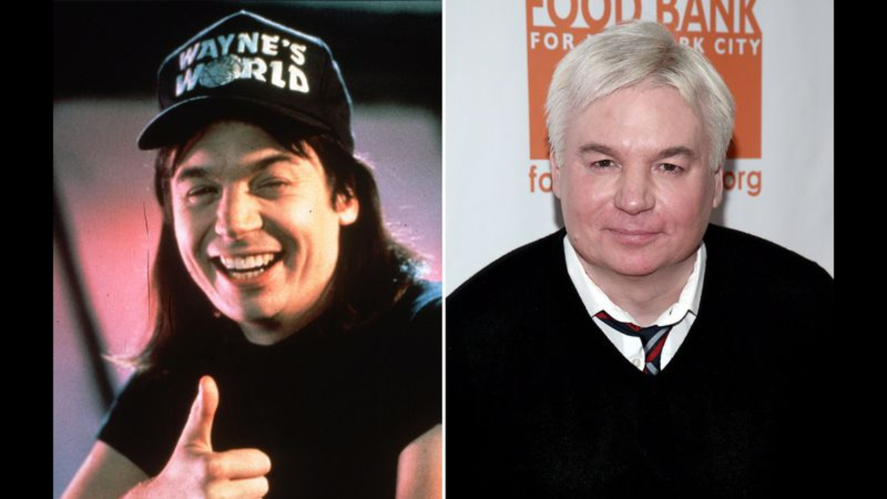 Mike Myers before and after plastic surgery.