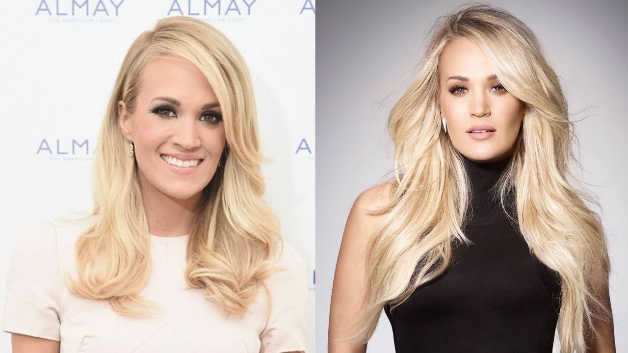'American Idol' Carrie Underwood's Plastic Surgery - Scar, Accident, Lip Injections, Nose Job!