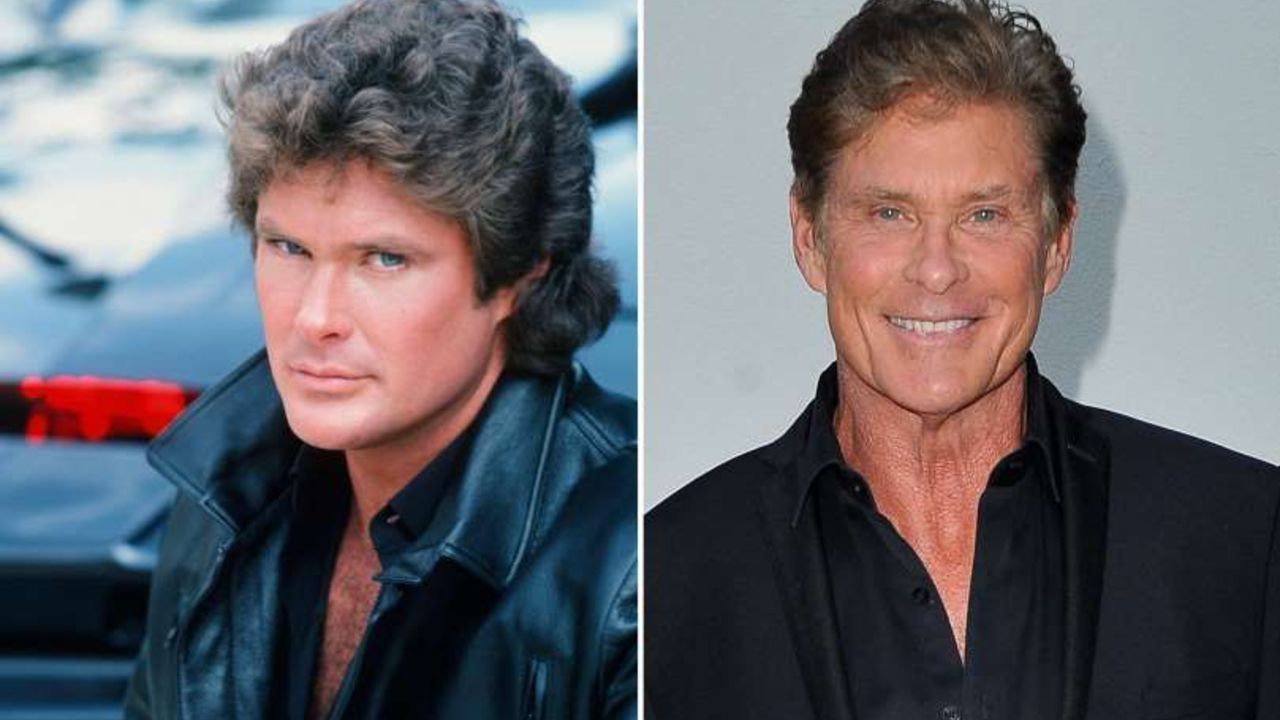 David Hasselhoff before and after alleged plastic surgery.