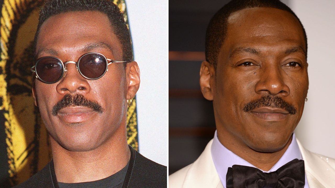 'Coming 2 America' Star Eddie Murphy's Plastic Surgery on His Face