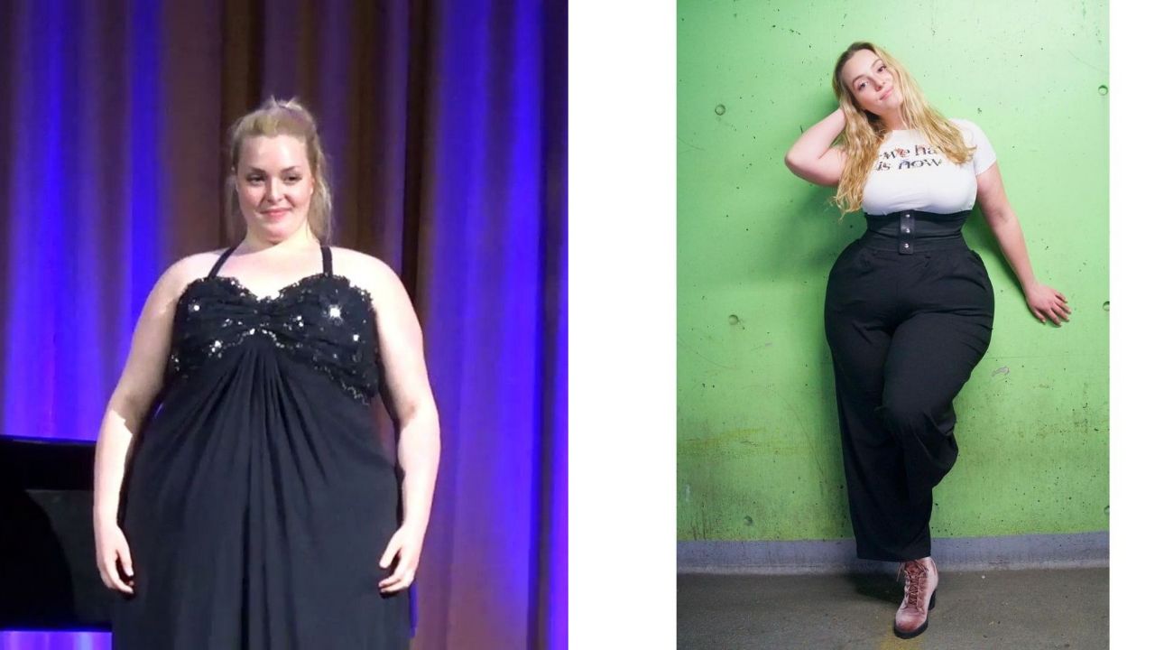 Grace Kinstler before and after weight loss surgery, making her hips stand out.