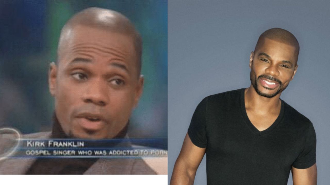 Kirk Franklin before and after plastic surgery.