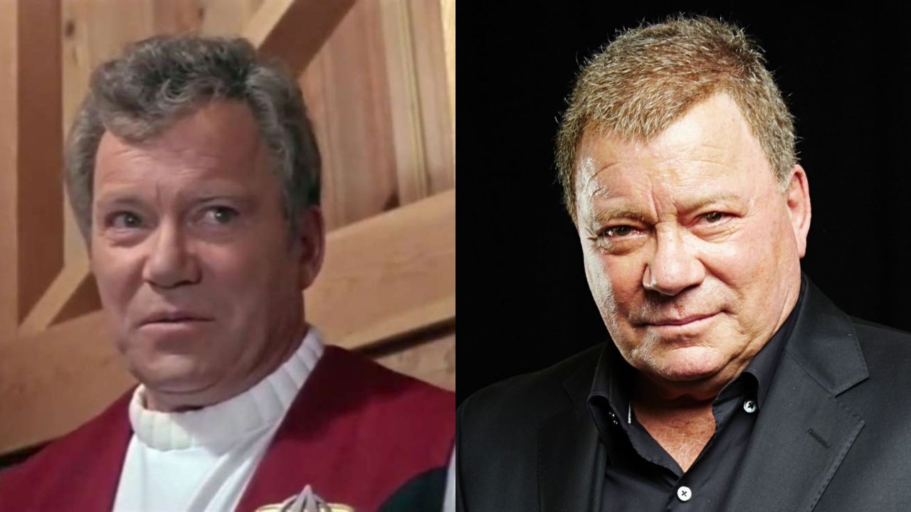 William Shatner before and after plastic surgery.