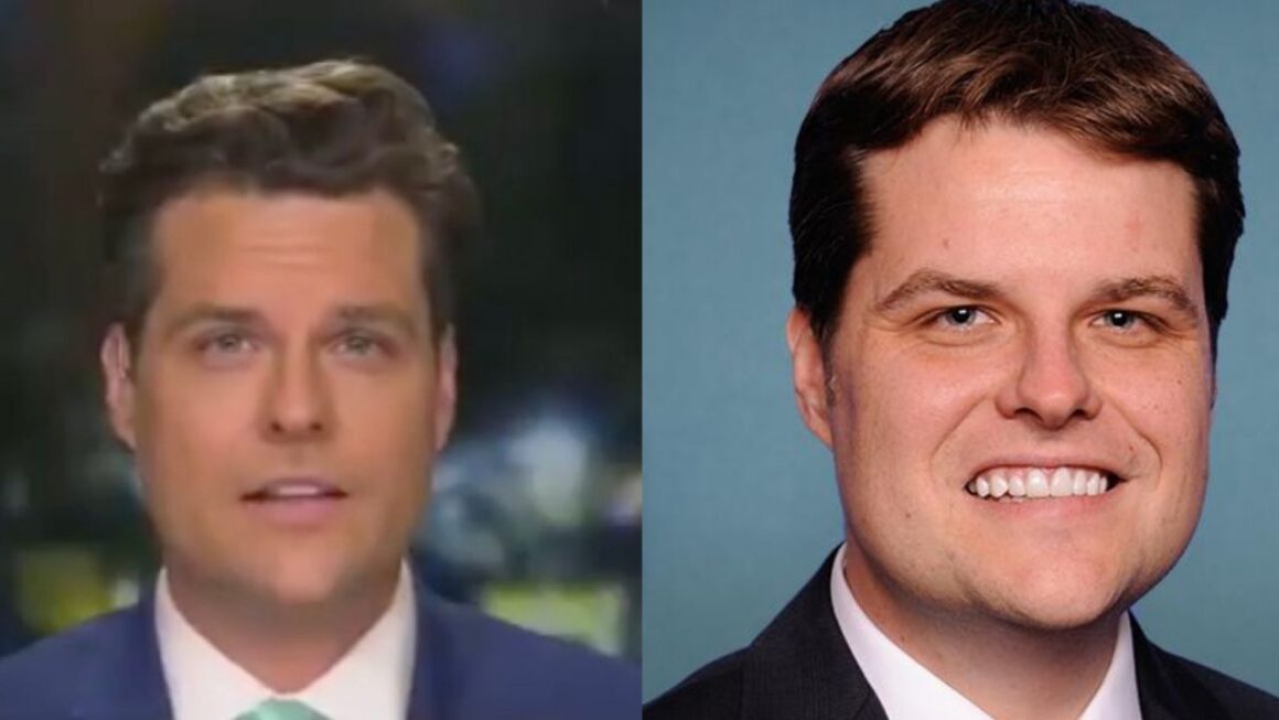 Real Truth About Matt Gaetz's Plastic Surgery Procedures