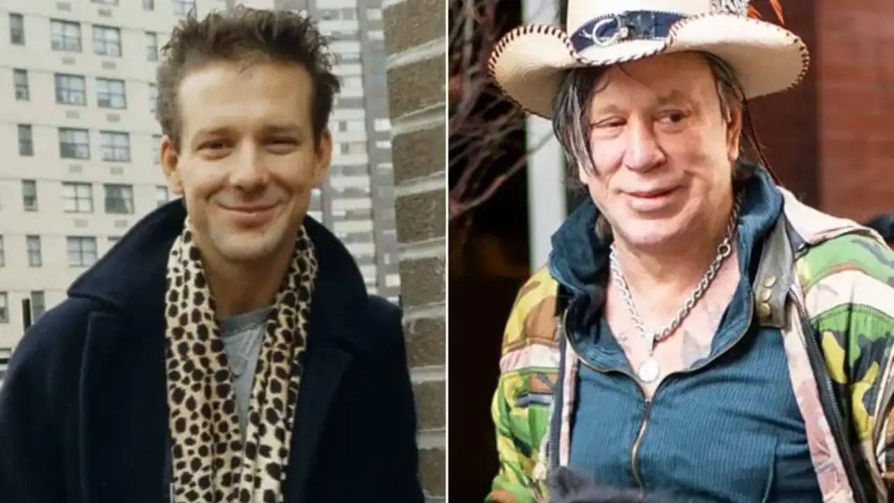 Mickey Rourke before and after botched plastic surgery on his face.