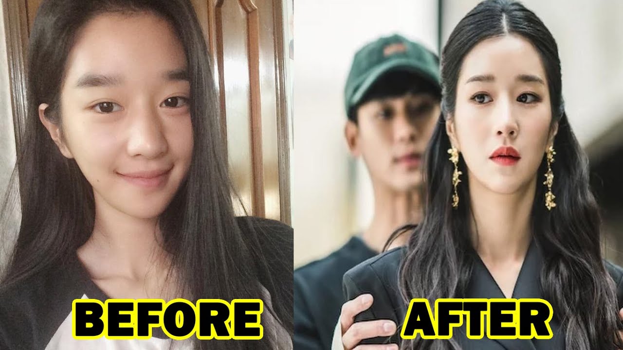 Korean Media Has Revealed The Evidence Of Seo Ye Ji Plastic Surgery Hot Sex Picture 1565