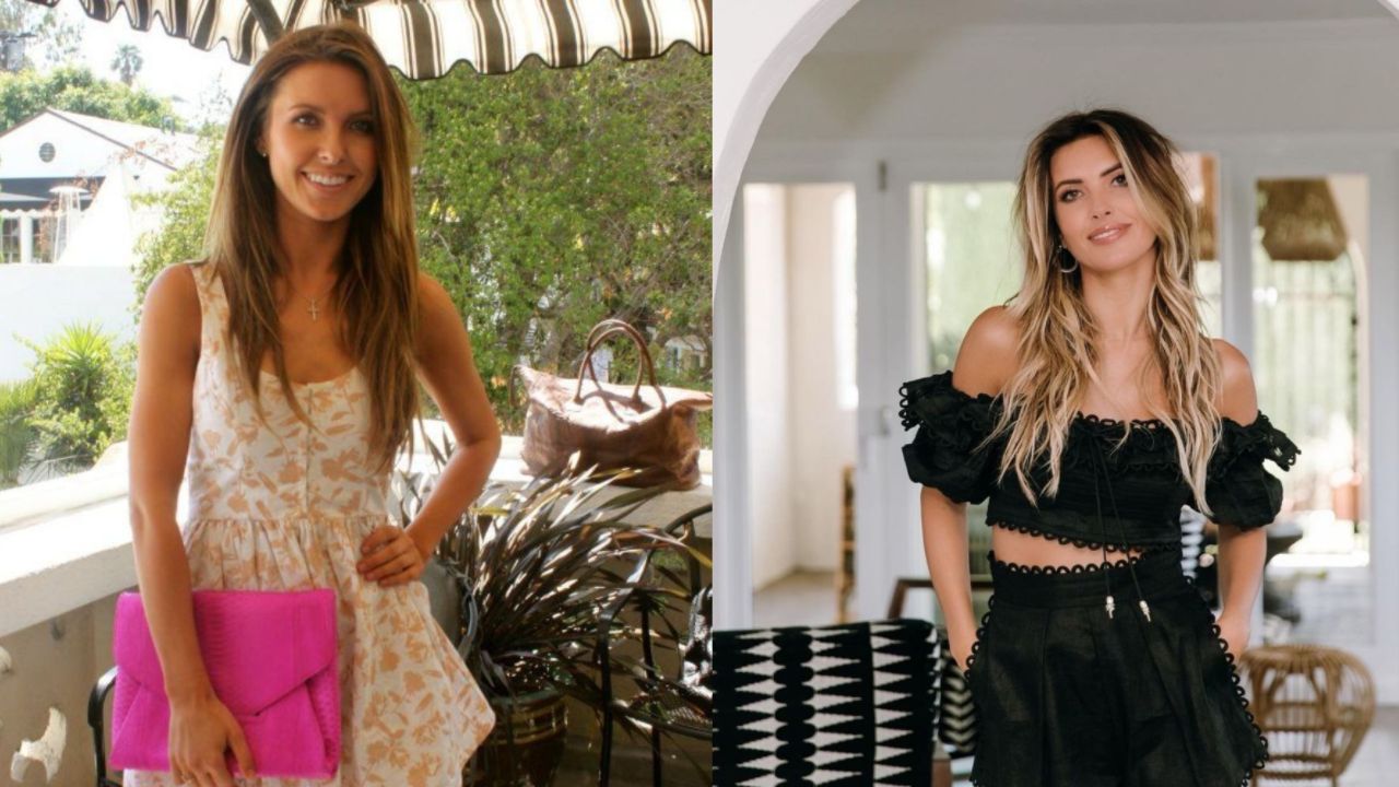 Audrina Patridge before and after plastic surgery.