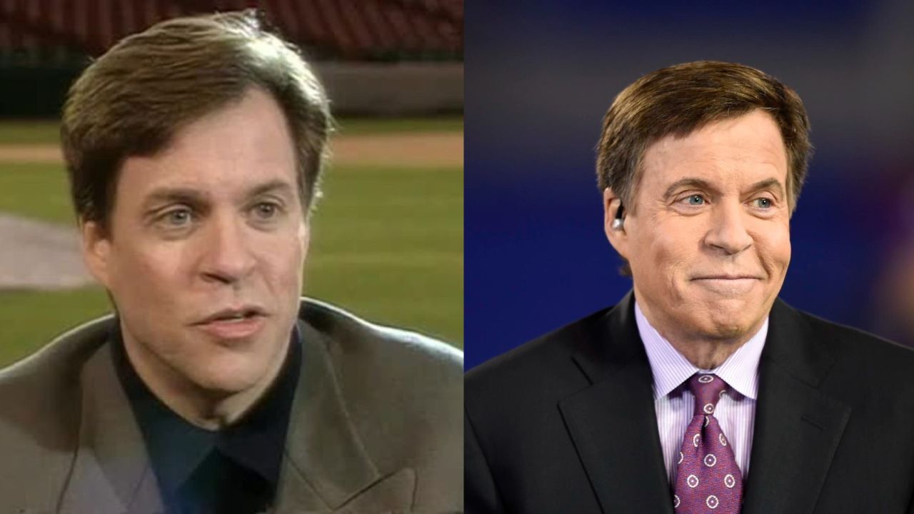 Bob Costas before and after plastic surgery.