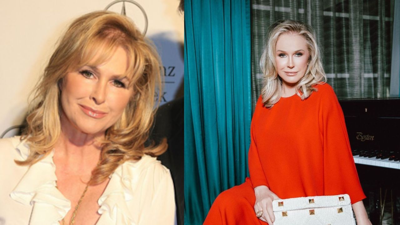 Kathy Hilton before and after alleged plastic surgery.