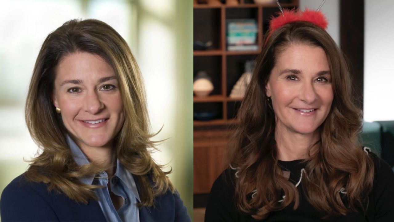 Melinda Gates before and after plastic surgery.