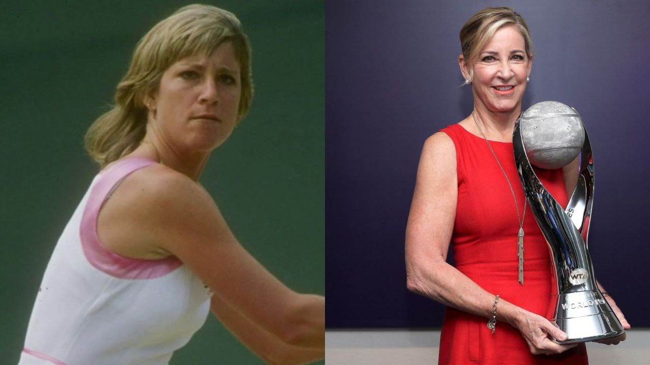 Chris Evert before and after plastic surgery.