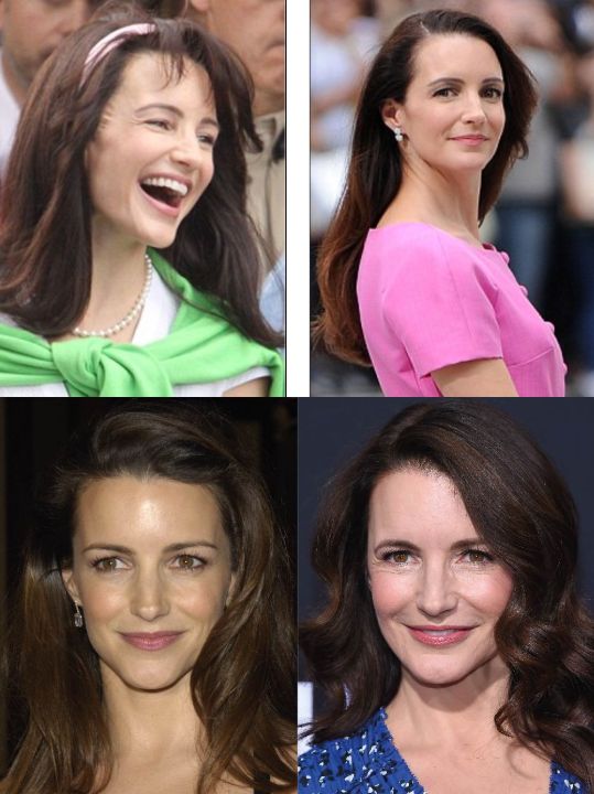 Kristin Davis' Plastic Surgery in 2021 What's Happened to Her Face?