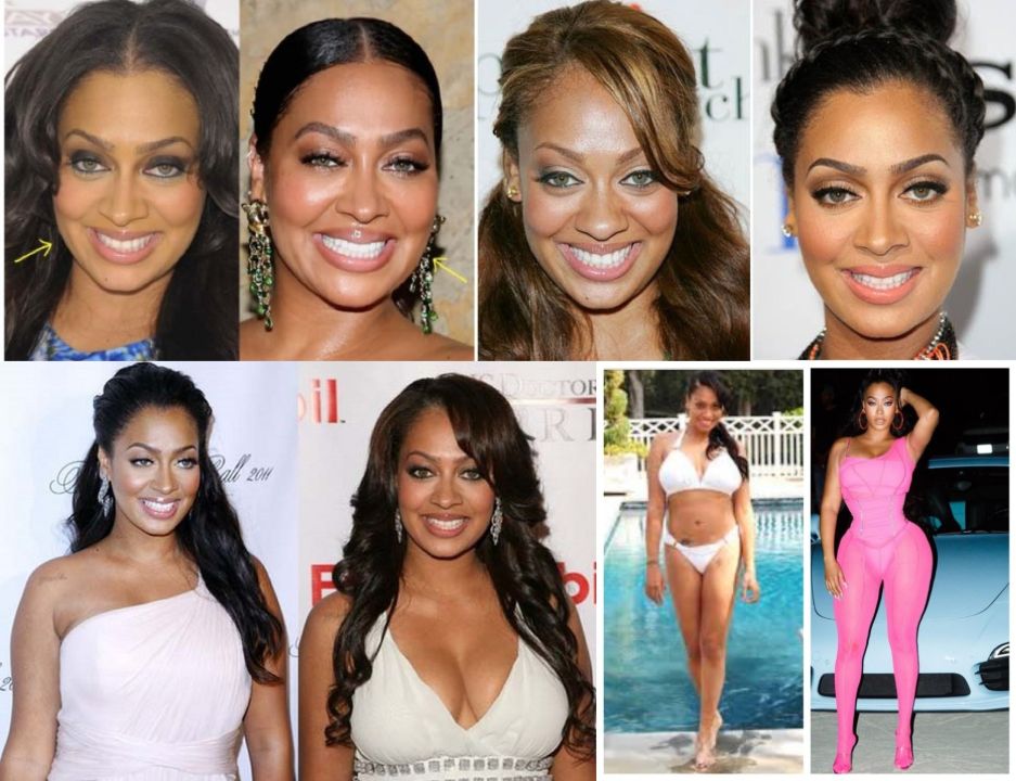 LaLa Anthony before and after plastic surgery, notably nose job, Botox, boob job, and butt lift.