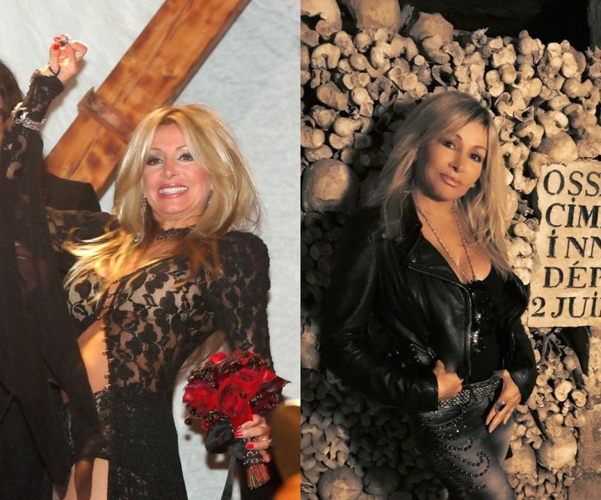 Suzette Snider before and after plastic surgery.