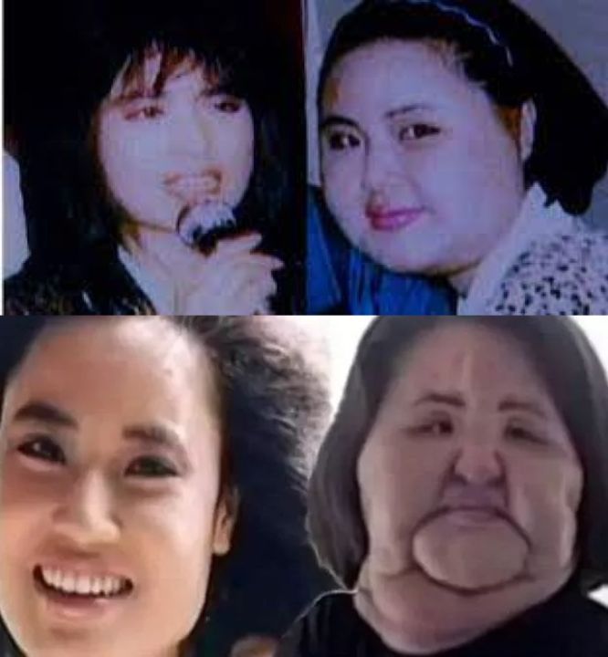 Hang Mioku before and after multiple plastic surgery procedures.