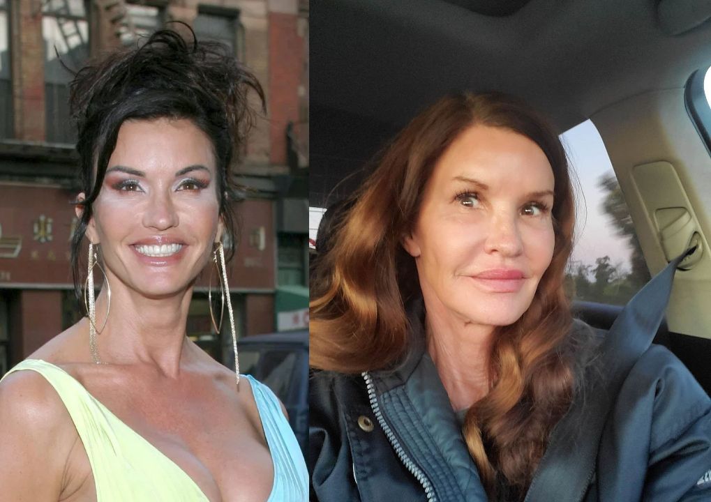 Janice Dickinsons Plastic Surgery Facelifts Boob Job Tummy Tuck