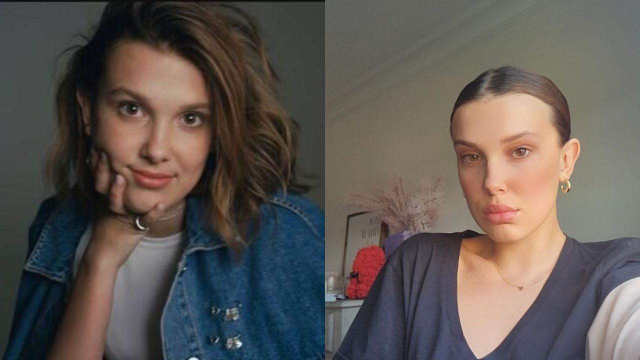 Millie Bobby Brown before and after plastic surgery.