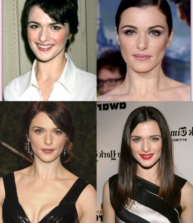 Rachel Weisz before and after alleged plastic surgery procedures, notably Botox injections.