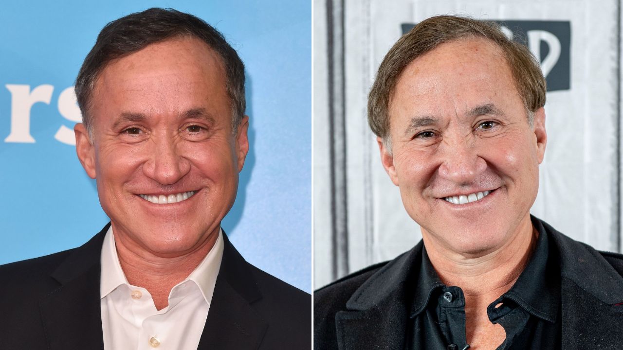 Terry Dubrow before and after plastic surgery, most notably fillers on his face.