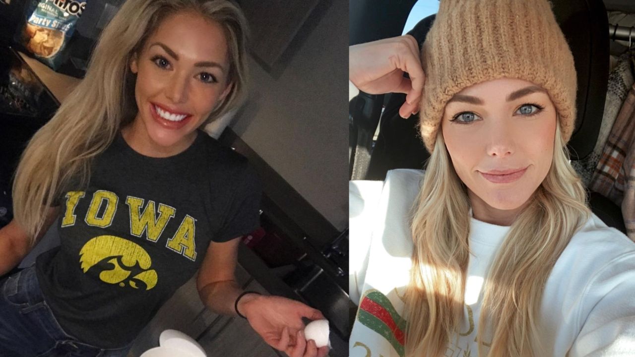 Kelsey Weier before and after alleged nose job plastic surgery.