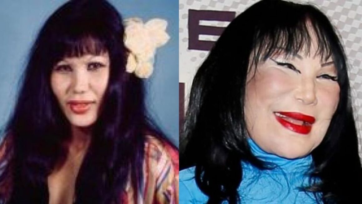 Lyn May's Plastic Surgery Destroyed Her Face What Exactly Went Wrong?