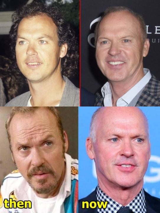 Michael Keaton before and after plastic surgery.