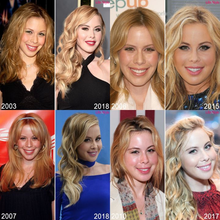 Tara Lipinski before and after alleged plastic surgery.