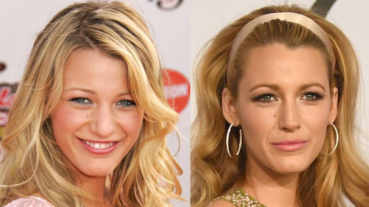 Blake Lively Before and After Nose Job Plastic Surgery - Check Out Her Old Nose on Sisterhood of the Traveling Pants