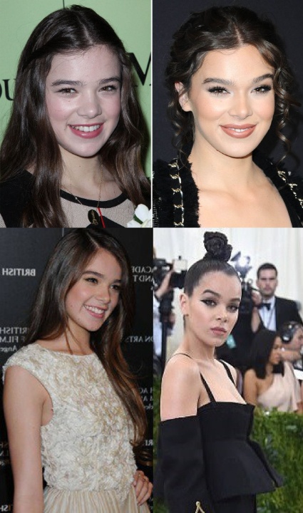 Hailee Steinfeld before and after alleged plastic surgery.