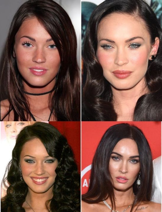 Megan Fox before and after plastic surgery.