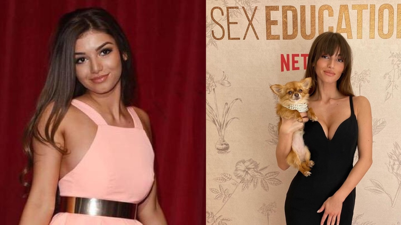 Mimi Keene before and after boob job plastic surgery.