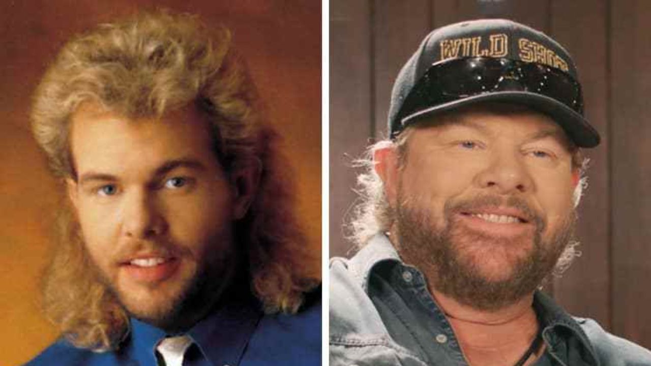 Toby Keith before and after plastic surgery.