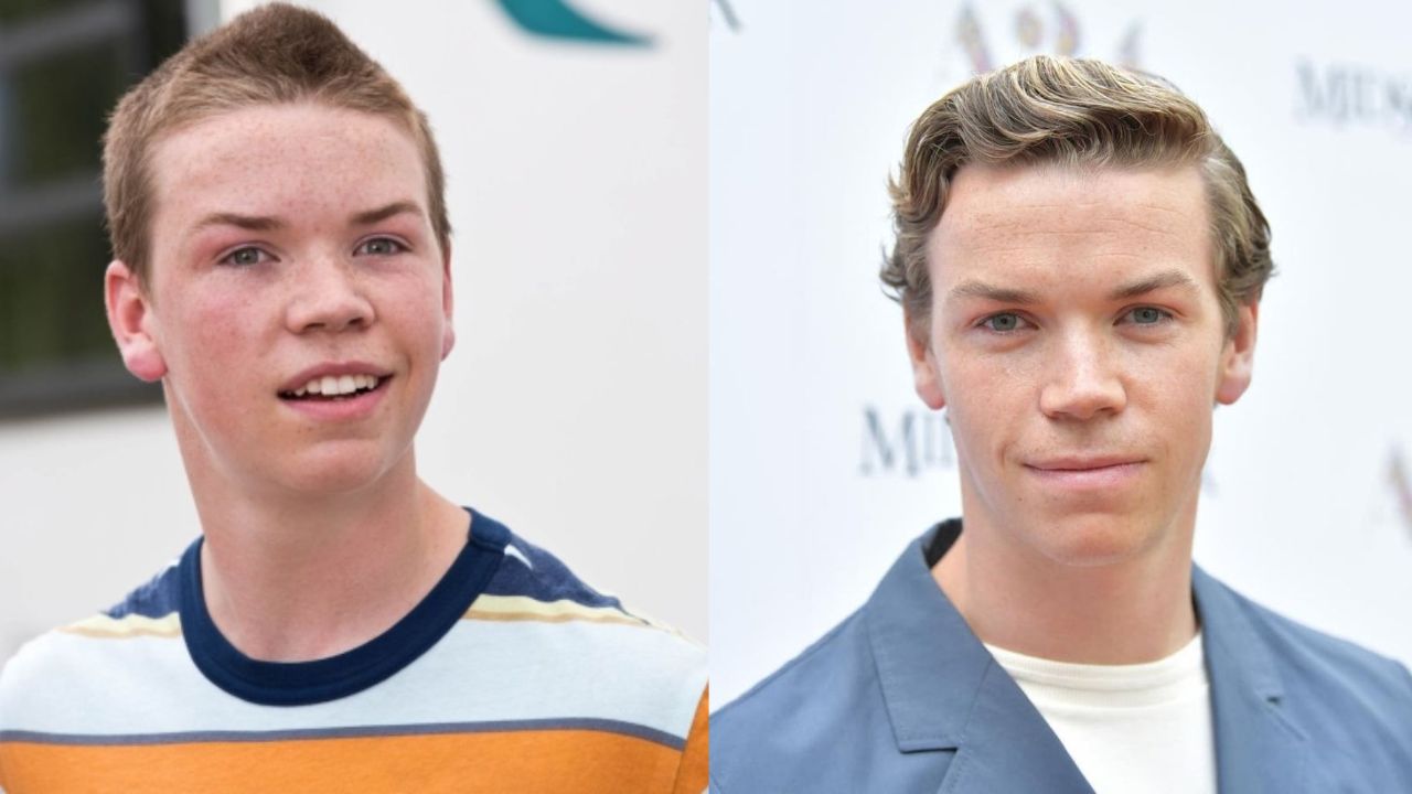 Will Poulter before and after alleged plastic surgery.