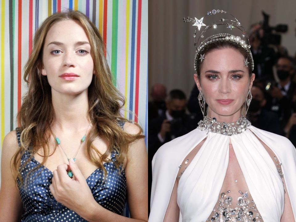 Emily Blunt before and after alleged plastic surgery.
