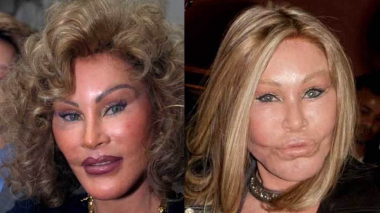 Jocelyn Wildenstein Before Plastic Surgery: Check Out Cat Face Lady Before and After!