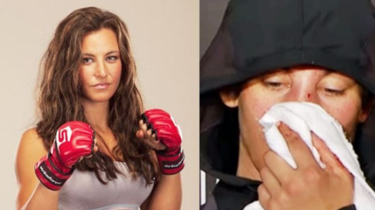 Miesha Tate's Plastic Surgery: Did the MMA Star Get a Nose Job?
