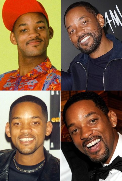Will Smith before and after alleged plastic surgery.
