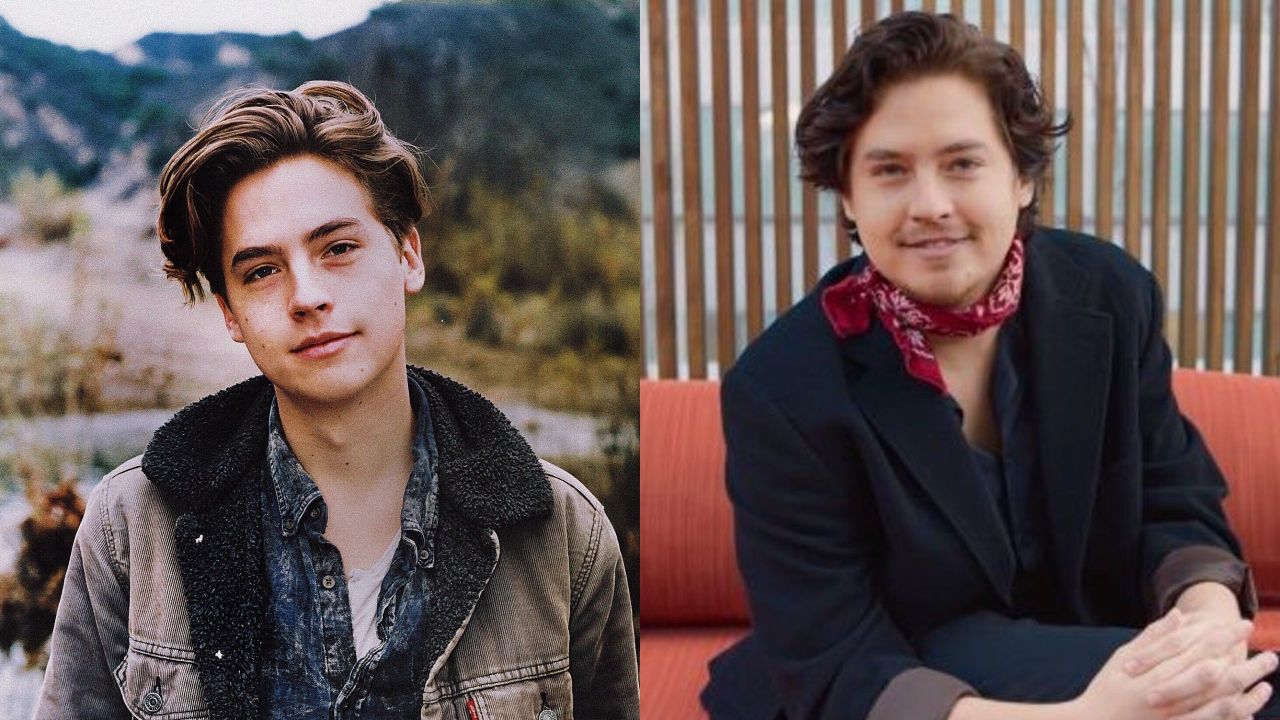 Cole Sprouse before and after plastic surgery.
