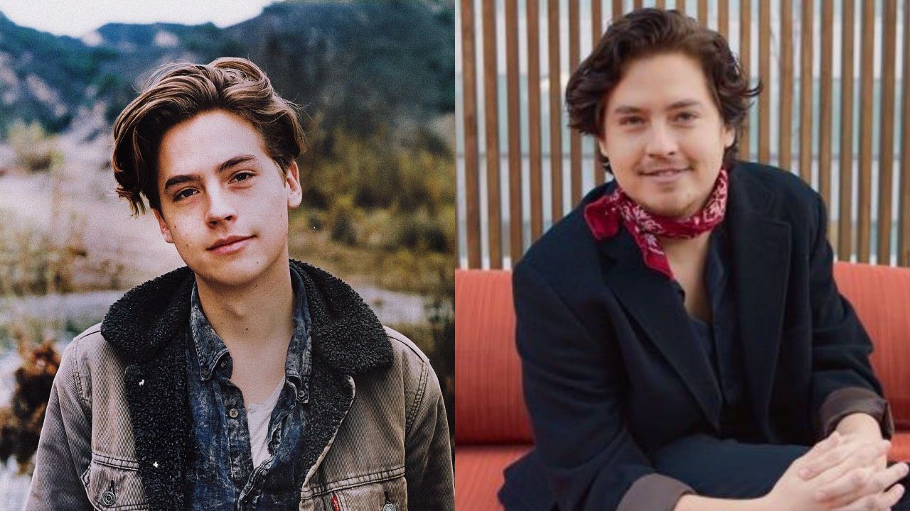 Cole Sprouse's Plastic Surgery: Did He Get a Nose Job? 