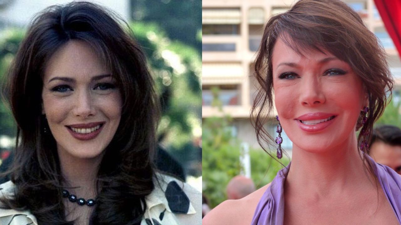 Hunter Tylo before and after plastic surgery.